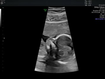 Obituary of Joe Michael Bugg II