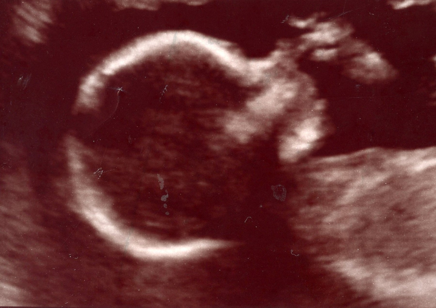 Obituary of Emry Belle Borunda