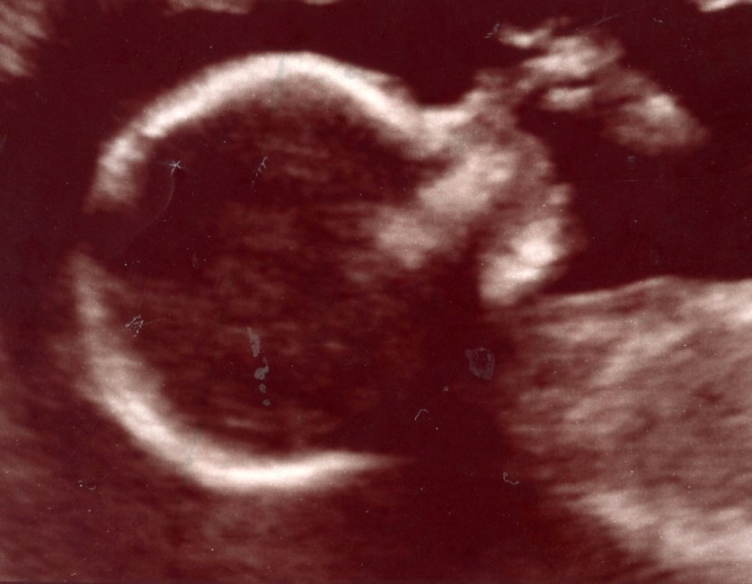 Obituary of Emry Belle Borunda