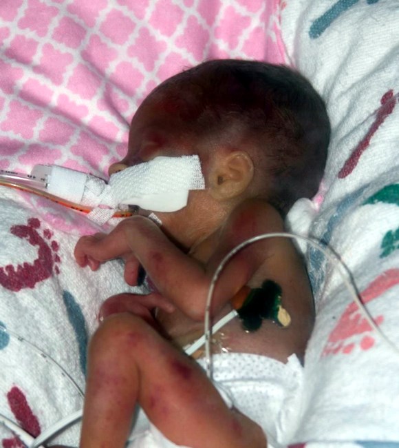 Obituary of Lily Grace Zehnder