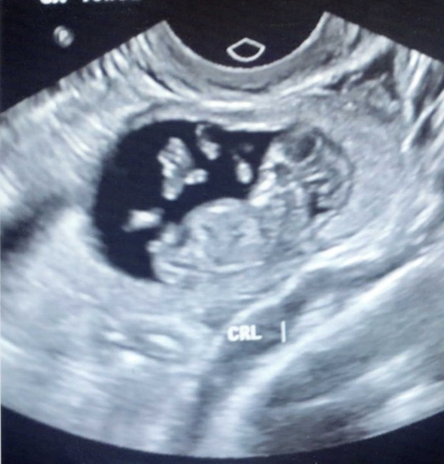 Obituary of Markell Lee Parks