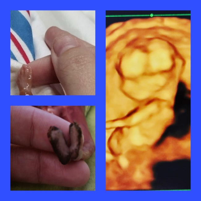 Obituary of Baby Julien Anthony Barajas