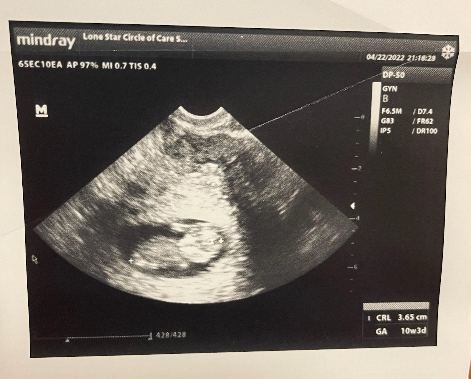 Obituary of Mattheous Rodriguez