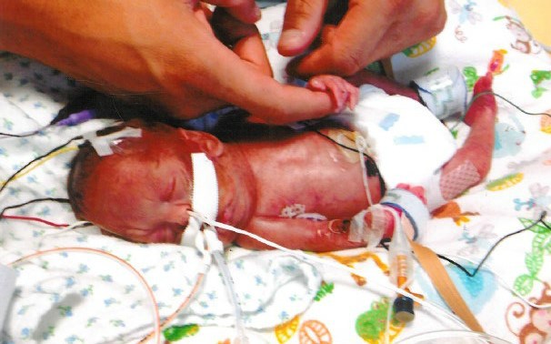 Obituary of Marcus Alexander Clark