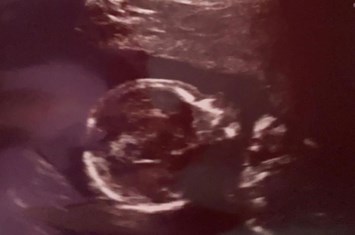 Obituary of Amaya Yeoman