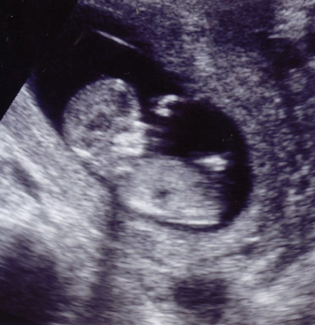 Obituary of Christian Bennett Vaughn