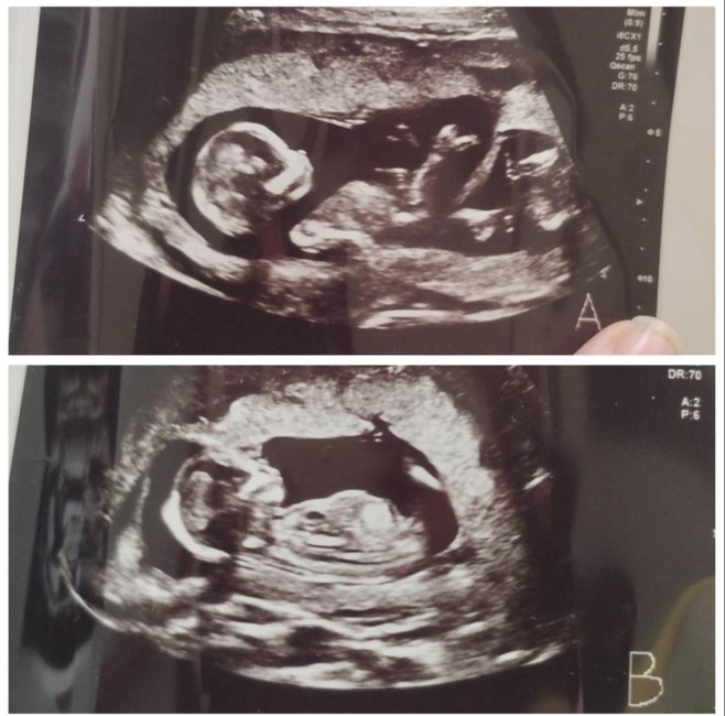 Obituario de Leonard Kenny & Leo James Boyd